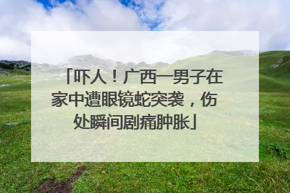 吓人！广西一男子在家中遭眼镜蛇突袭，伤处瞬间剧痛肿胀